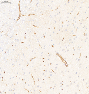 06 GB113495_20210627_C69221020202_glut1_R brain d1000_IHC_20.0x.jpg