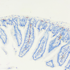 01 GB113499_20210728_C100521062302_lyve-1_M small intestine d2000_IHC_20x.jpg