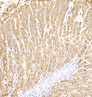 03 GB12225_7D8G8_Cytokeratin-7 170401_M stomach d500_40.0x_IHC.jpg