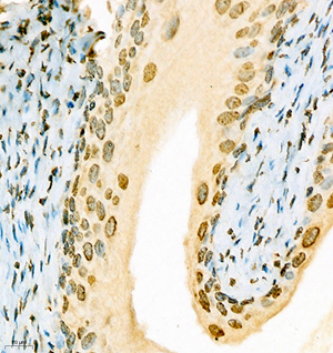 04 GB112254_201001_HES1_C134 M bladder d1000_40.0x_IHC.jpg