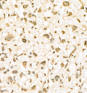 05 GB112254_201001_HES1_C134 M placenta d1000_40.0x_IHC.jpg