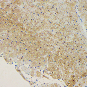 02 GB15241_20230424_HSP70_H56_H5620230413 M ischemia-reperfusion injury heart d500_40.0x_IHC.jpg