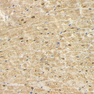 03 GB15241_20230424_HSP70_H56_H5620230413 R ischemia-reperfusion injury heart d500_40.0x_IHC.jpg