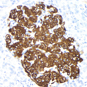 01 GB15334_20230424_Insulin_H55_H5520230413 H pancreas d1000_40.0x_IHC.jpg