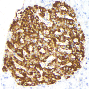 03 GB15334_20230424_Insulin_H55_H5520230413 R pancreas d1000_40.0x_IHC.jpg