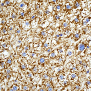 01 GB115483_14241-3_C6_ M  liver   d100_40.0x_IHC.jpg