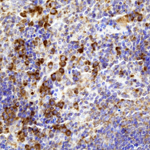 02 GB115483_14241-3_C6_ M  spleen   d100_40.0x_IHC.jpg