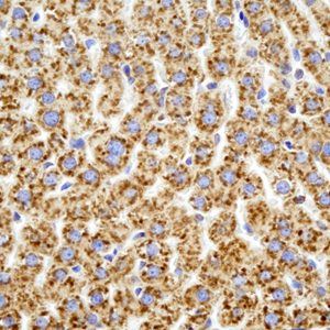 04 GB115483_14241-3_C6_ R  liver   d100_40.0x_IHC.jpg