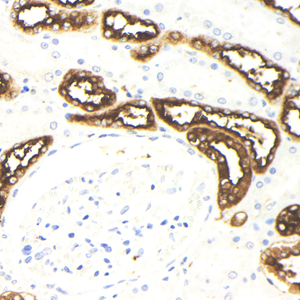 02 GB154939_20230424_MUC1_H53_H5320230413 H kidney d1000_40.0x_IHC.jpg