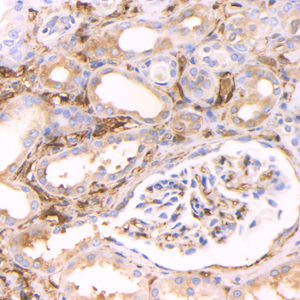 04 GB155215_20230522_TGM2_H5220_H5220230413 H kidney d1000_40.0x_IHC.jpg