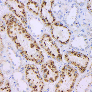 04 GB121012_20230522_NapsinA_4H10H7_4H10H7 20230404 H  kidney d1000_IHC.jpg