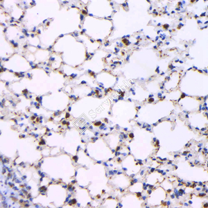 08 GB121012_20230522_NapsinA_4H10H7_4H10H7 20230404 M lung     d1000_IHC.jpg