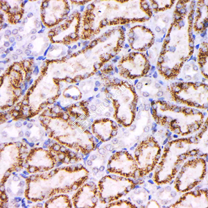 09 GB121012_20230522_NapsinA_4H10H7_4H10H7 20230404 R kidney     d1000_IHC.jpg