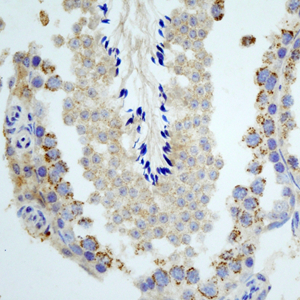 01 GB115506_14560-3_DIABLO_ M testis d200_40.0x_IHC.jpg
