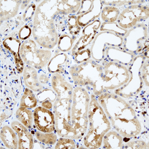 01 GB115508_14565-2_S100A1_ H kidney d200_40.0x_IHC.jpg
