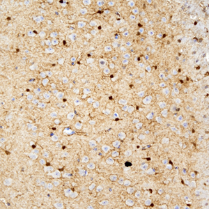 02 GB115508_14565-2_S100A1_ M brain d200_40.0x_IHC.jpg