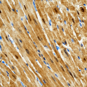03 GB115508_14565-2_S100A1_ M heart d200_40.0x_IHC.jpg