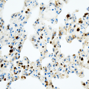 04 GB115508_14565-2_S100A1_ R  lung d200_40.0x_IHC.jpg