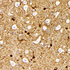 05 GB115508_14565-2_S100A1_ R brain d200_40.0x_IHC.jpg