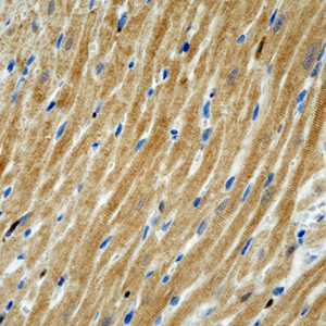 06 GB115508_14565-2_S100A1_ R heart d200_40.0x_IHC.jpg