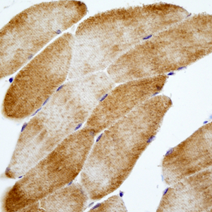 08 GB115508_14565-2_S100A1_ M skeletal muscle d200_40.0x_IHC.jpg