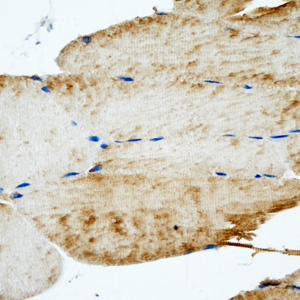 09 GB115508_14565-2_S100A1_ R  skeletal muscle d200_40.0x_IHC.jpg