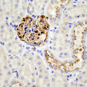 01 GB115509_14575-2_GSN_ M kidney d100_40.0x_IHC.jpg