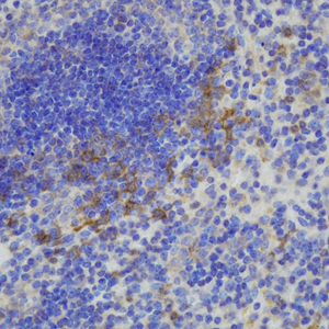 02 GB115509_14575-2_GSN_ M spleen d100_40.0x_IHC.jpg
