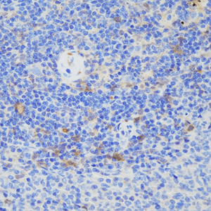 03 GB115509_14575-2_GSN_ R  spleen d100_40.0x_IHC.jpg