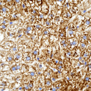 02 GB115505_14555-2_PON1_ M liver d200_40.0x_IHC.jpg