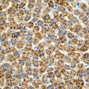 04 GB115505_14555-2_PON1_ R liver d200_40.0x_IHC.jpg