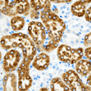 01 GB115490_14445-1_CES2_ M kidney d200_40.0x_IHC.jpg