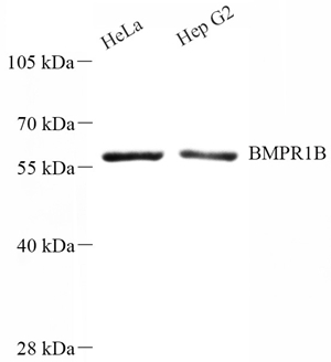 01 GB115498_14513-2 BMPR1B_WB.jpg