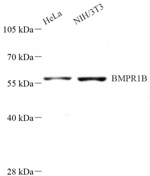 01 GB115499_14514-3 BMPR1B_WB.jpg