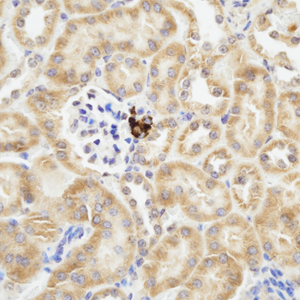 02 GB115500_14519-2_Renin_ M kidney d200_40.0x_IHC.jpg