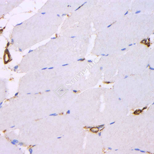 02 GB12044_20230625_a-smA_18F11A3_ 20230526_d1000_H skeletal muscle_ IHC.jpg