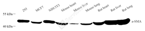 Anti-alpha smooth muscle Actin Mouse mAb