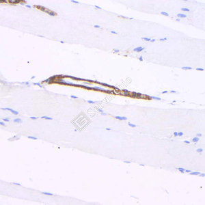 03 GB12960_20230625_caldesmon_3A3G9_ 20230517_d1000_R skeletal muscle_ IHC.jpg