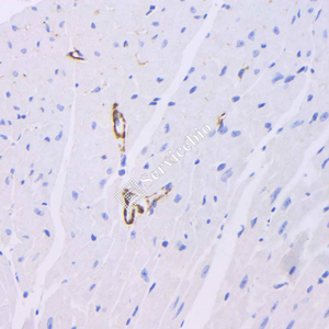 04 GB12960_20230625_caldesmon_3A3G9_ 20230517_d1000_M heart_ IHC.jpg