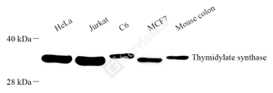 01 GB122057_8H10G7 Thymidylate synthase_WB.jpg