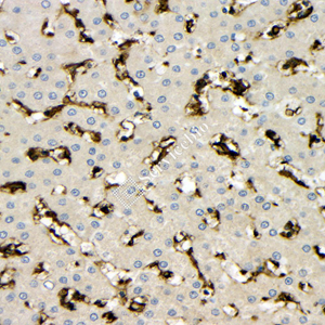 05 GB115523_20230627_HAL_14608_1 H liver d300_40x_IHC.jpg