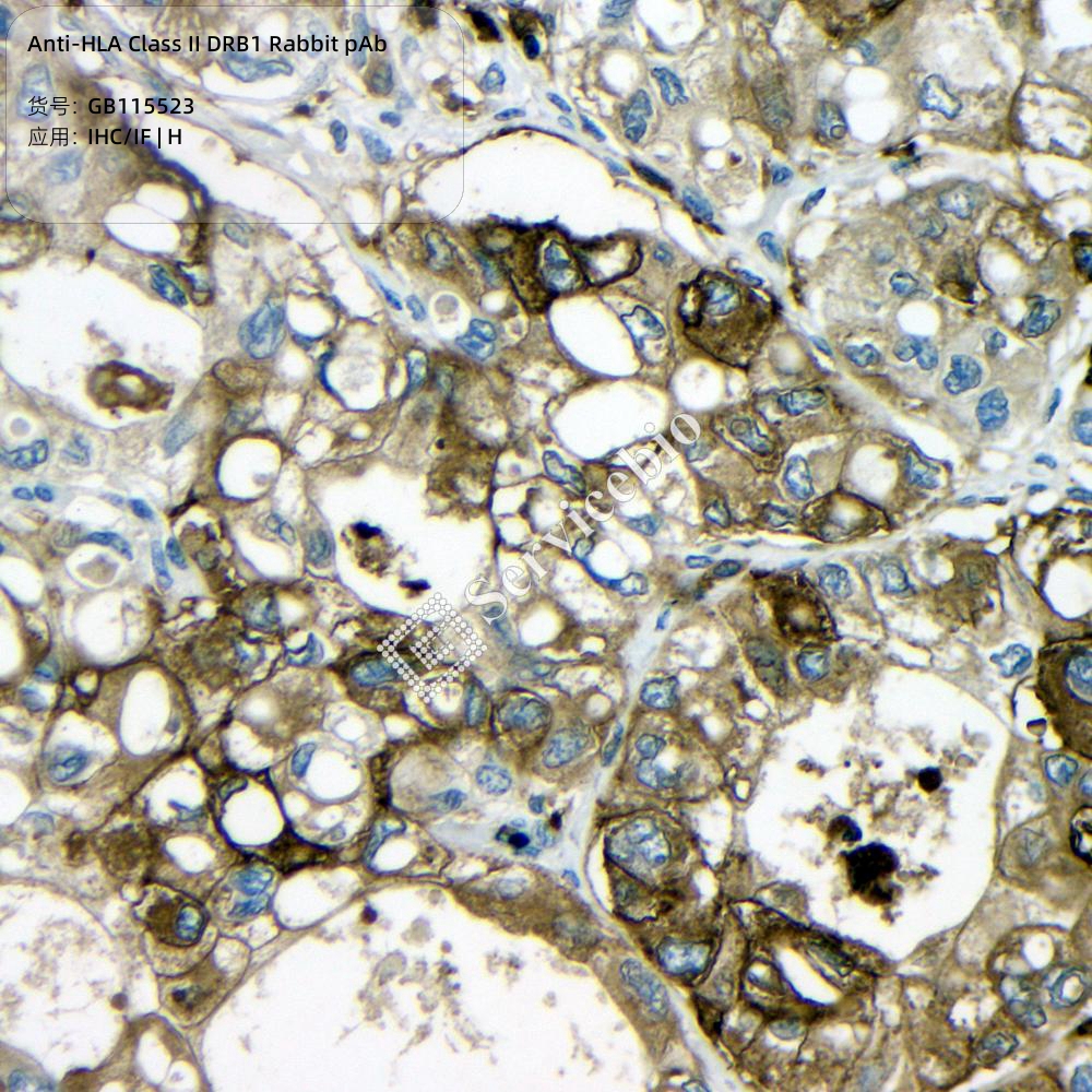 HLA-Drb1 (B11) Rabbit mAb
