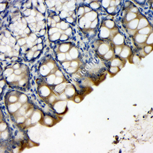 01 GB115524_20230627_CytochromeP4502E1_14613-1  R colon d100_40x_IHC.jpg