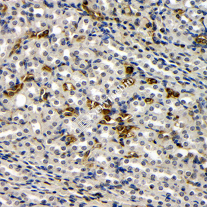 01 GB115534_20230627_ng2_14675-2  M kidney d100_40x_IHC.jpg