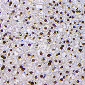 04 GB115543_20230627_ATR_14704_2 M liver d100_40x_IHC.jpg