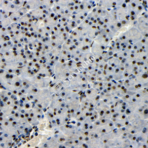 06 GB115547_20230627_TARDBP_14738_2 M pancreas d100_40x_IHC.jpg