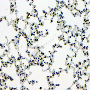 07 GB115547_20230627_TARDBP_14738_2 M lung d100_40x_IHC.jpg