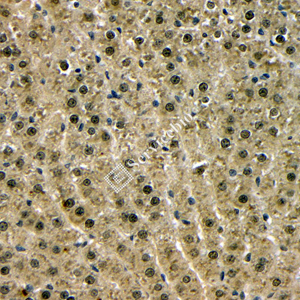 03 GB115549_20230627_HNF4_14749_2 R liver d100_40x_IHC.jpg