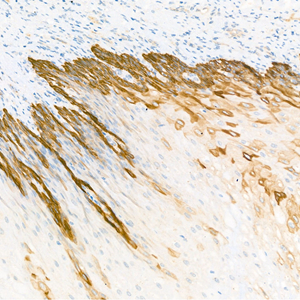 03 GB12803_CK14_2H1H2_d500_R skin_18x_IHC.jpg