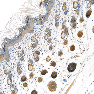 03 GB111556_alpha Actinin_M skin_5367_d900_21.5x_IHC.jpg